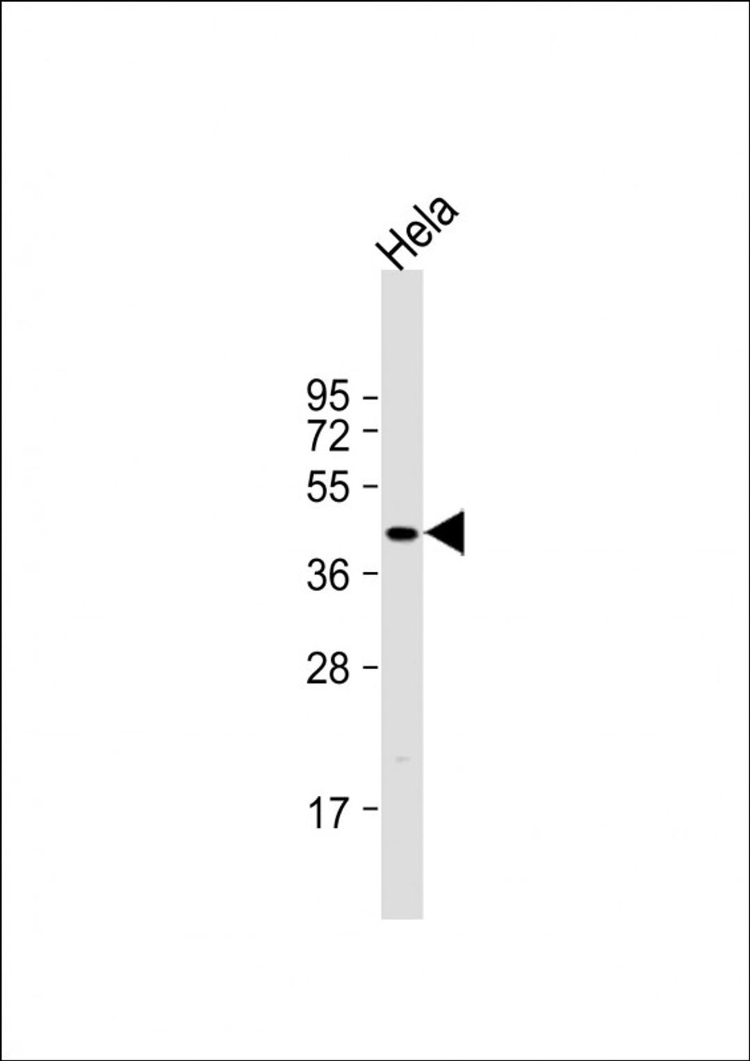 Western Blot at 1:1000 dilution + Hela whole cell lysate Lysates/proteins at 20 ug per lane.