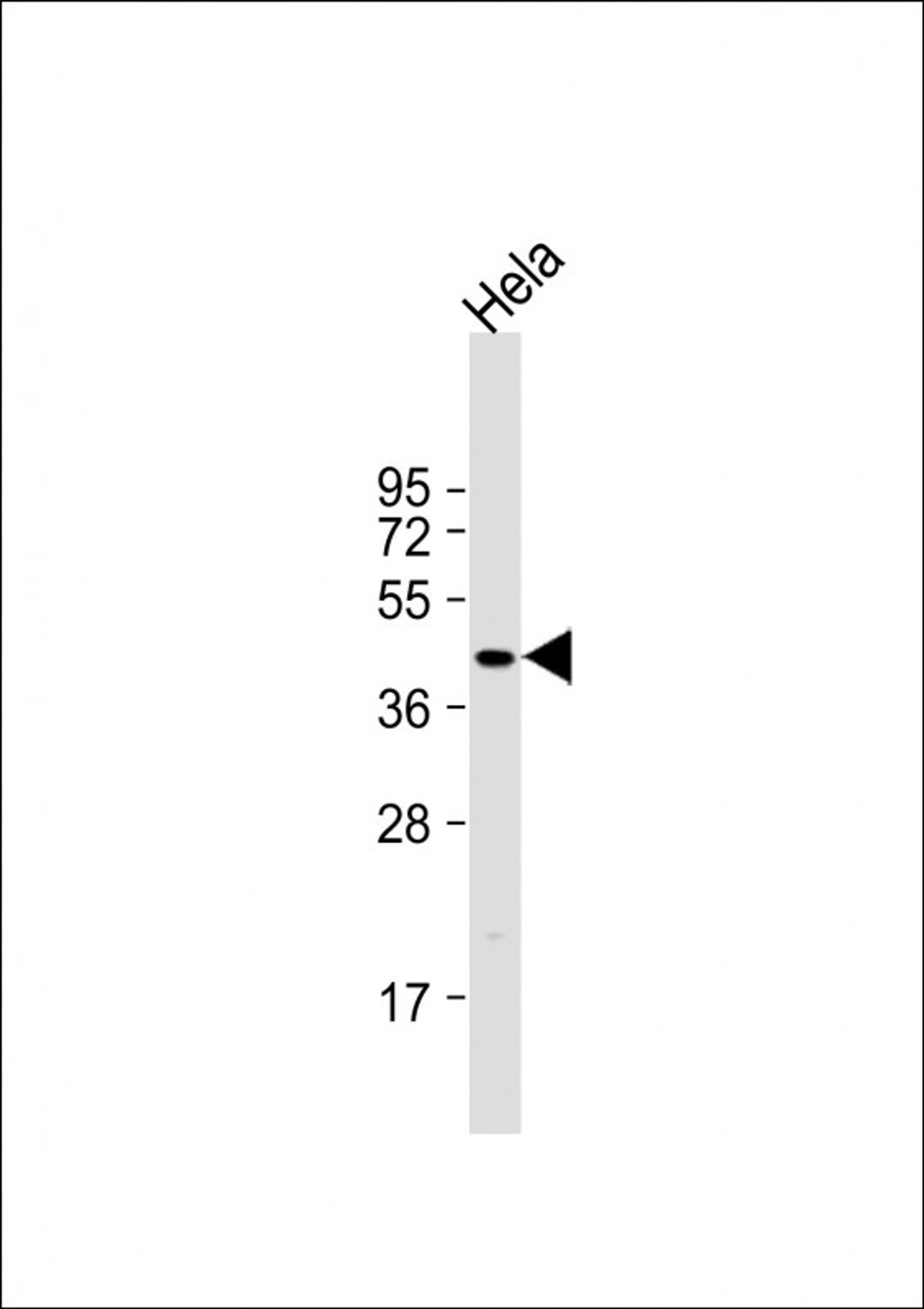 Western Blot at 1:1000 dilution + Hela whole cell lysate Lysates/proteins at 20 ug per lane.