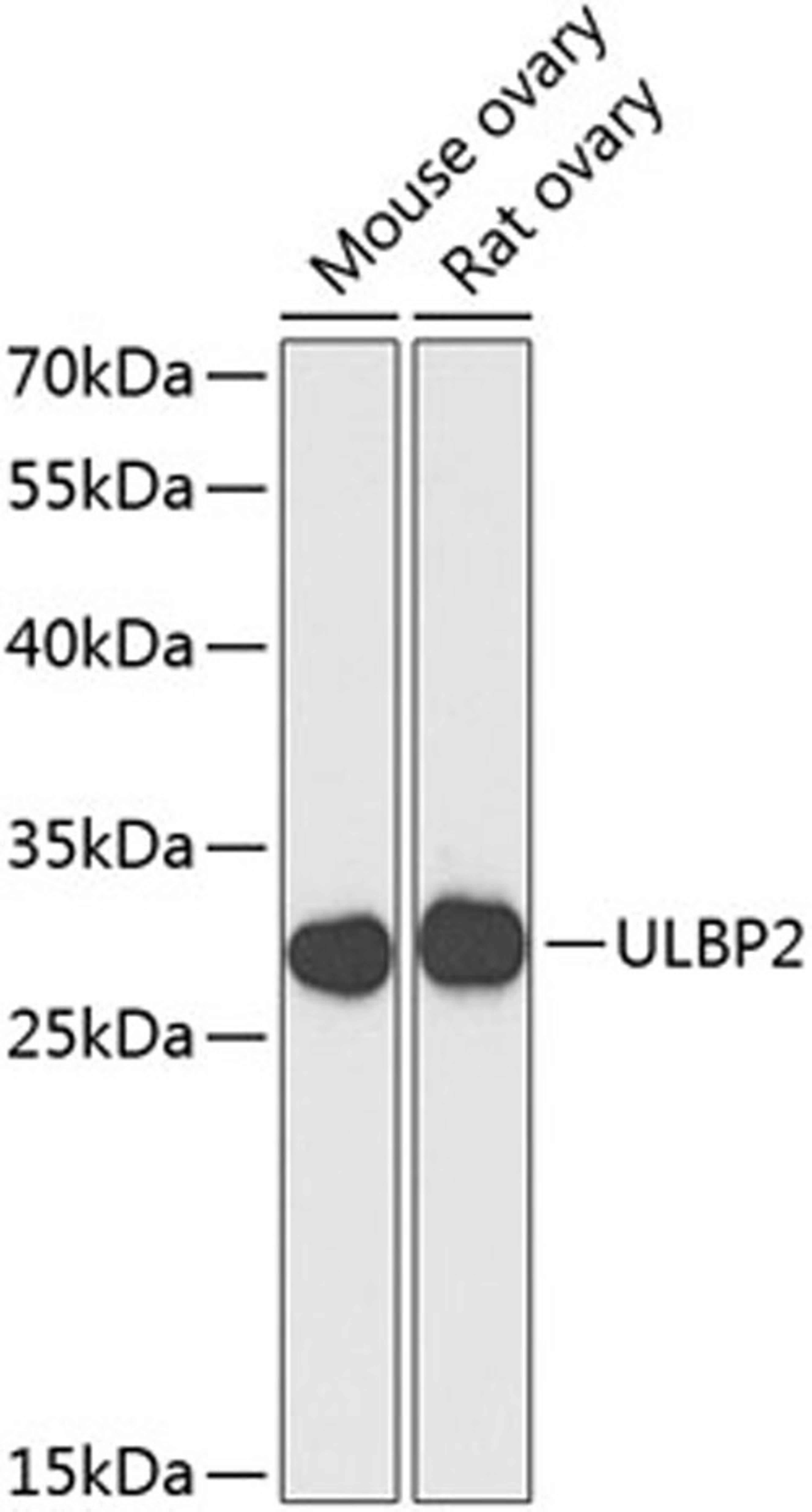 Western blot - ULBP2 antibody (A8264)