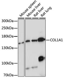 Western blot - COL1A1 antibody (A16891)