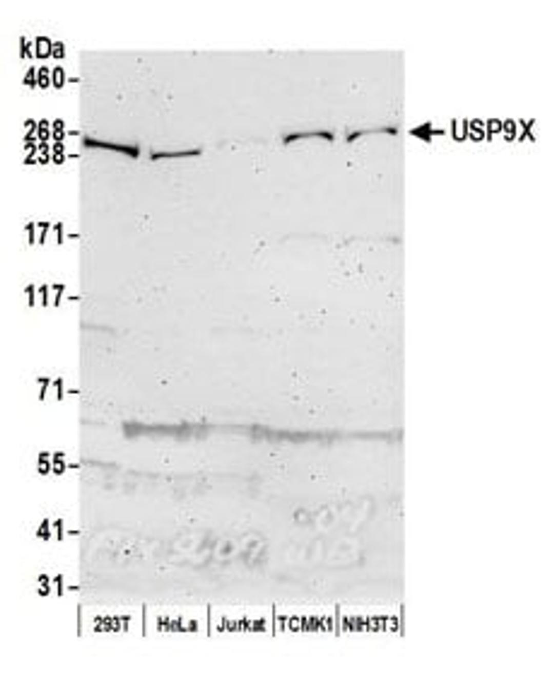 Detection of human and mouse USP9X by western blot.