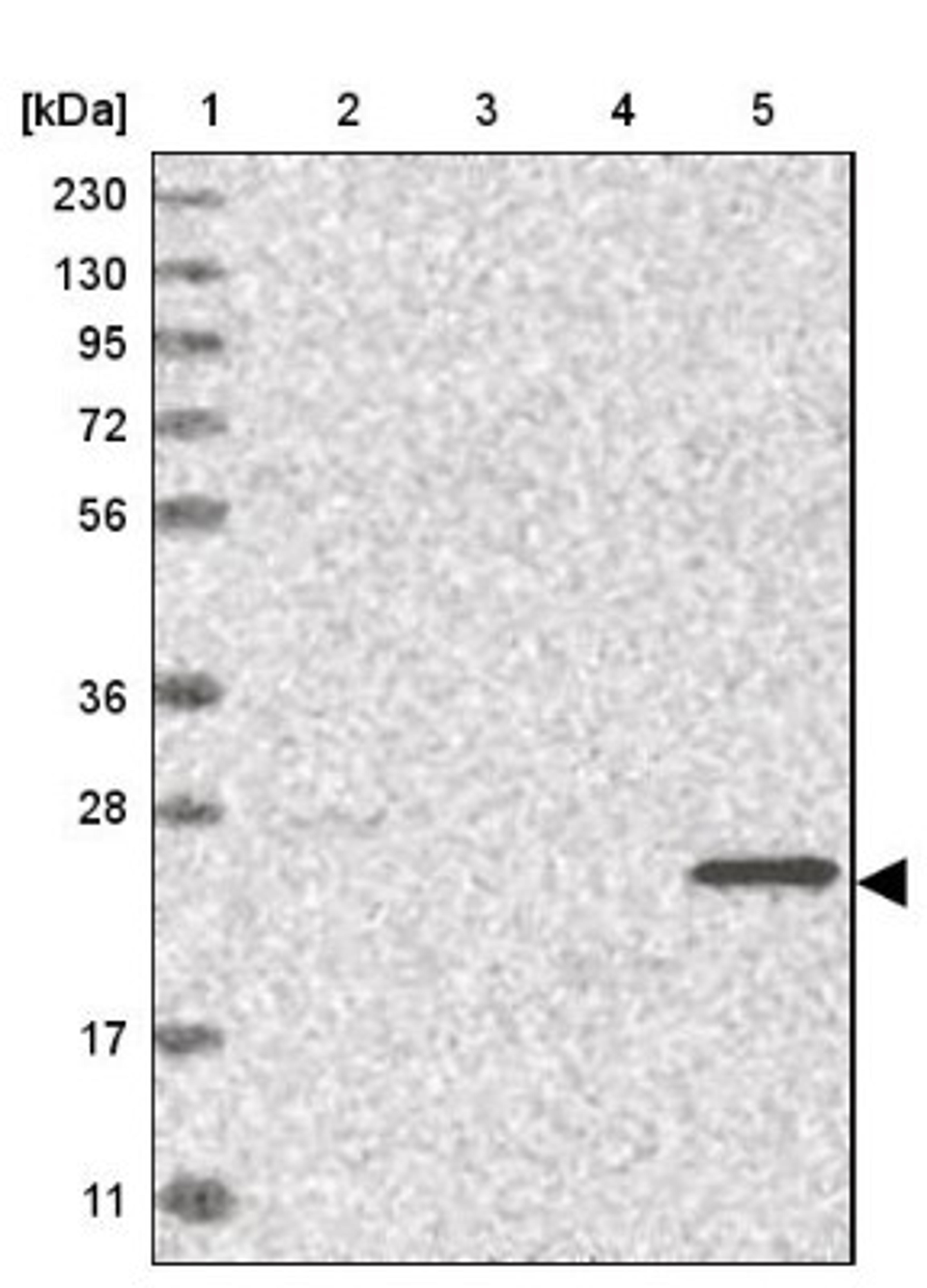 Western Blot: Dlx6 Antibody [NBP1-85929] - Lane 1: Marker [kDa] 230, 130, 95, 72, 56, 36, 28, 17, 11<br/>Lane 2: Human cell line RT-4<br/>Lane 3: Human cell line U-251MG sp<br/>Lane 4: Human plasma (IgG/HSA depleted)<br/>Lane 5: Human liver tissue