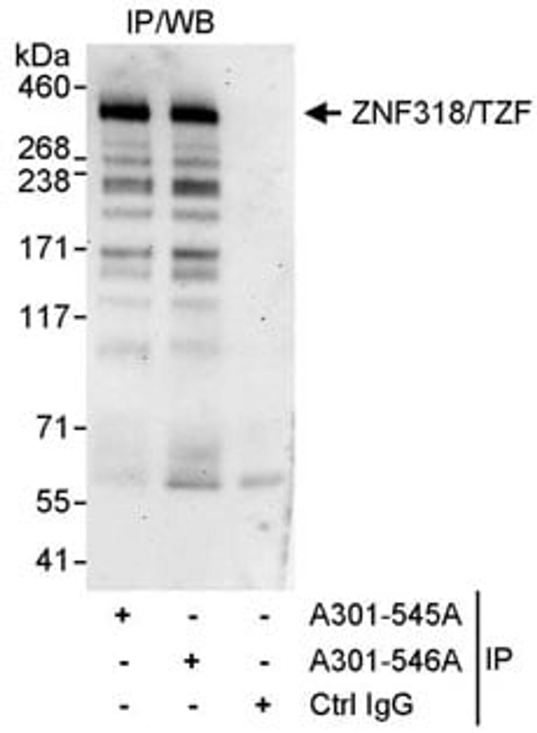 Detection of human ZNF318/TZF by western blot of immunoprecipitates.