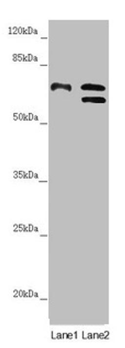Western blot. All lanes: CDC45 antibody at 1.05µg/ml. Lane 1: K562 whole cell lysate. Lane 2: 293T whole cell lysate. Secondary. Goat polyclonal to rabbit IgG at 1/10000 dilution. Predicted band size: 66, 61, 69 kDa. Observed band size: 66, 69 kDa