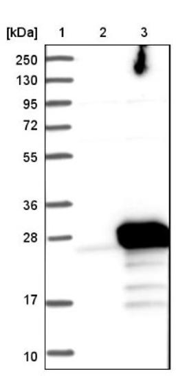 Western Blot: Frequenin Antibody [NBP1-89820] - Lane 1: Marker [kDa] 250, 130, 95, 72, 55, 36, 28, 17, 10<br/>Lane 2: Negative control (vector only transfected HEK293T lysate)<br/>Lane 3: Over-expression lysate (Co-expressed with a C-terminal myc-DDK tag (~3.1 kDa) in mammalian HEK293T cells, LY402303)