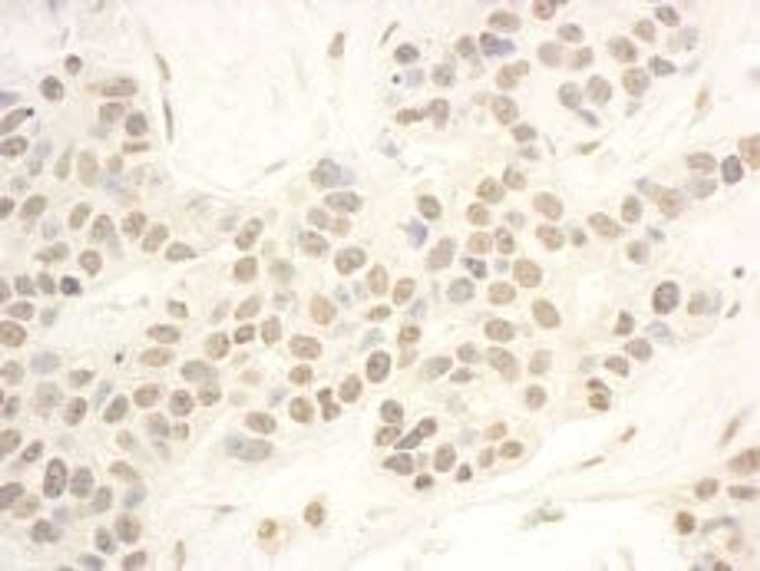 Detection of human NOP56 by immunohistochemistry.