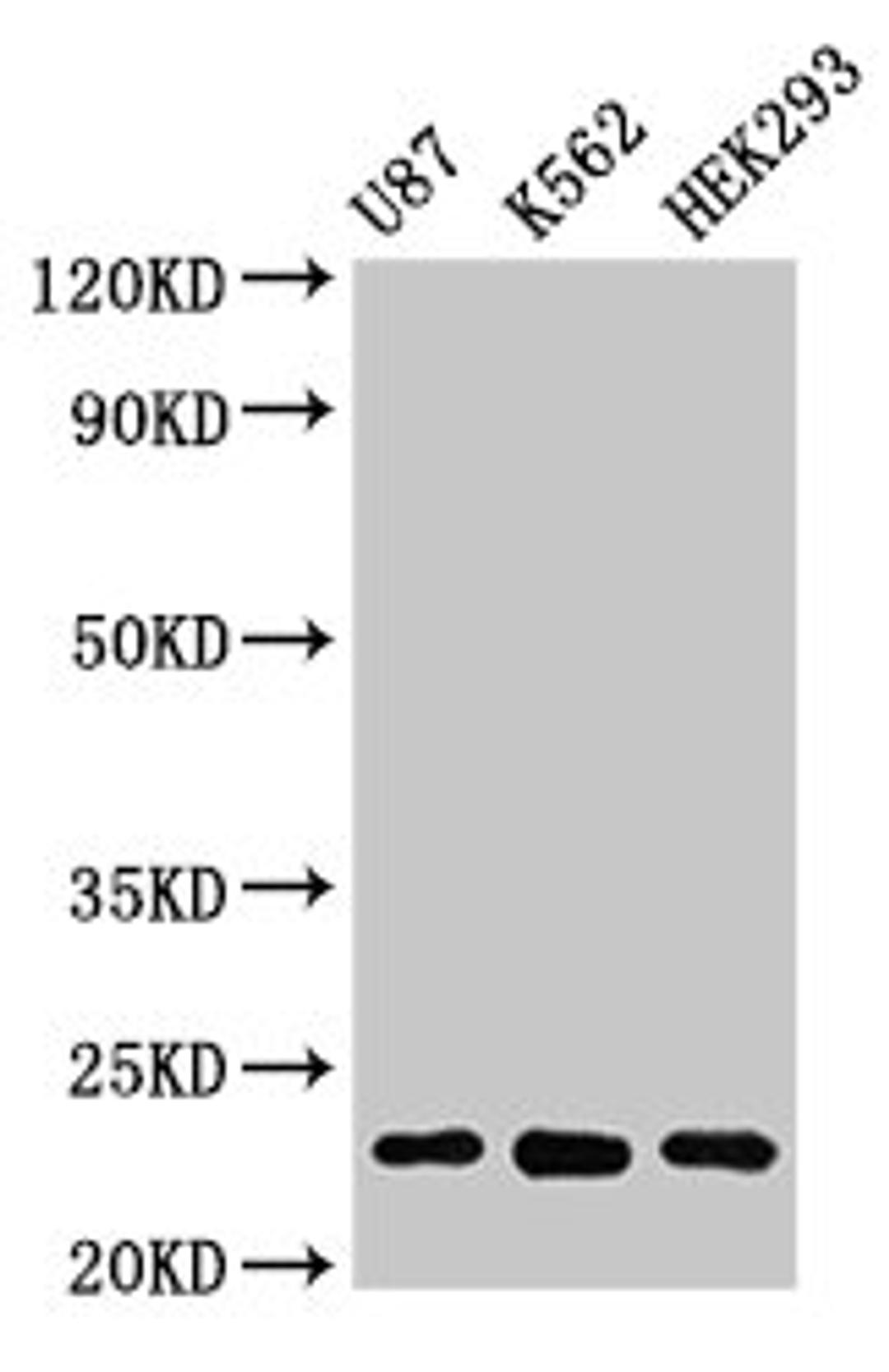 Western Blot. Positive WB detected in: U87 whole cell lysate, K562 whole cell lysate, HEK293 whole cell lysate. All lanes: HIST1H1B antibody at 1µg/ml. Secondary. Goat polyclonal to rabbit IgG at 1/50000 dilution. Predicted band size: 23 kDa. Observed band size: 23 kDa