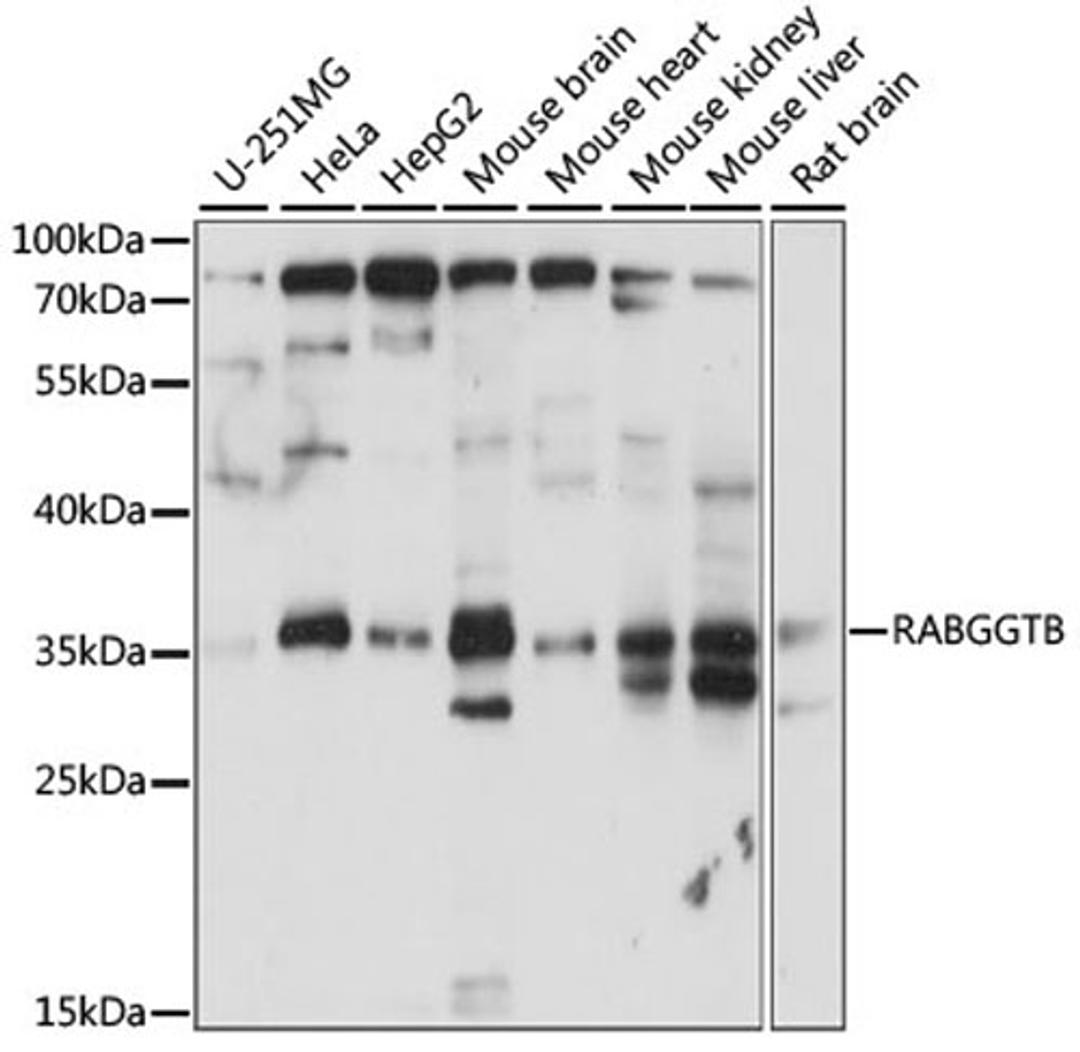 Western blot - RABGGTB antibody (A15310)