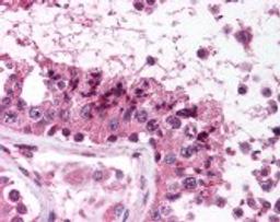 Immunohistochemistry staining of MAGEC1 in testis (formalin-fixed paraffin embedded) tissue using MAGEC1 Antibody.