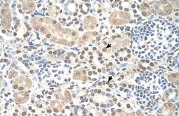 Antibody used in IHC on Human kidney.