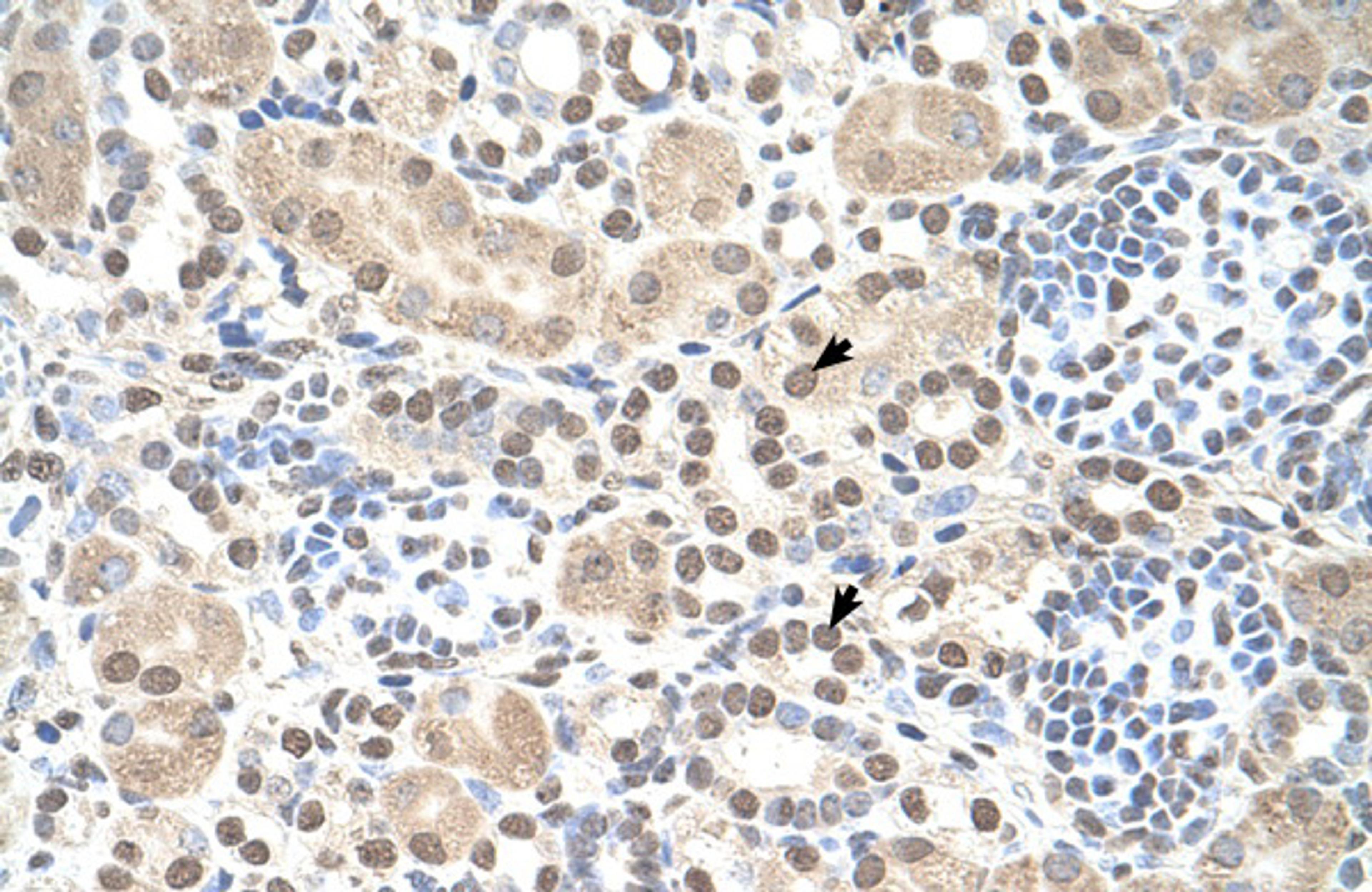 Antibody used in IHC on Human kidney.