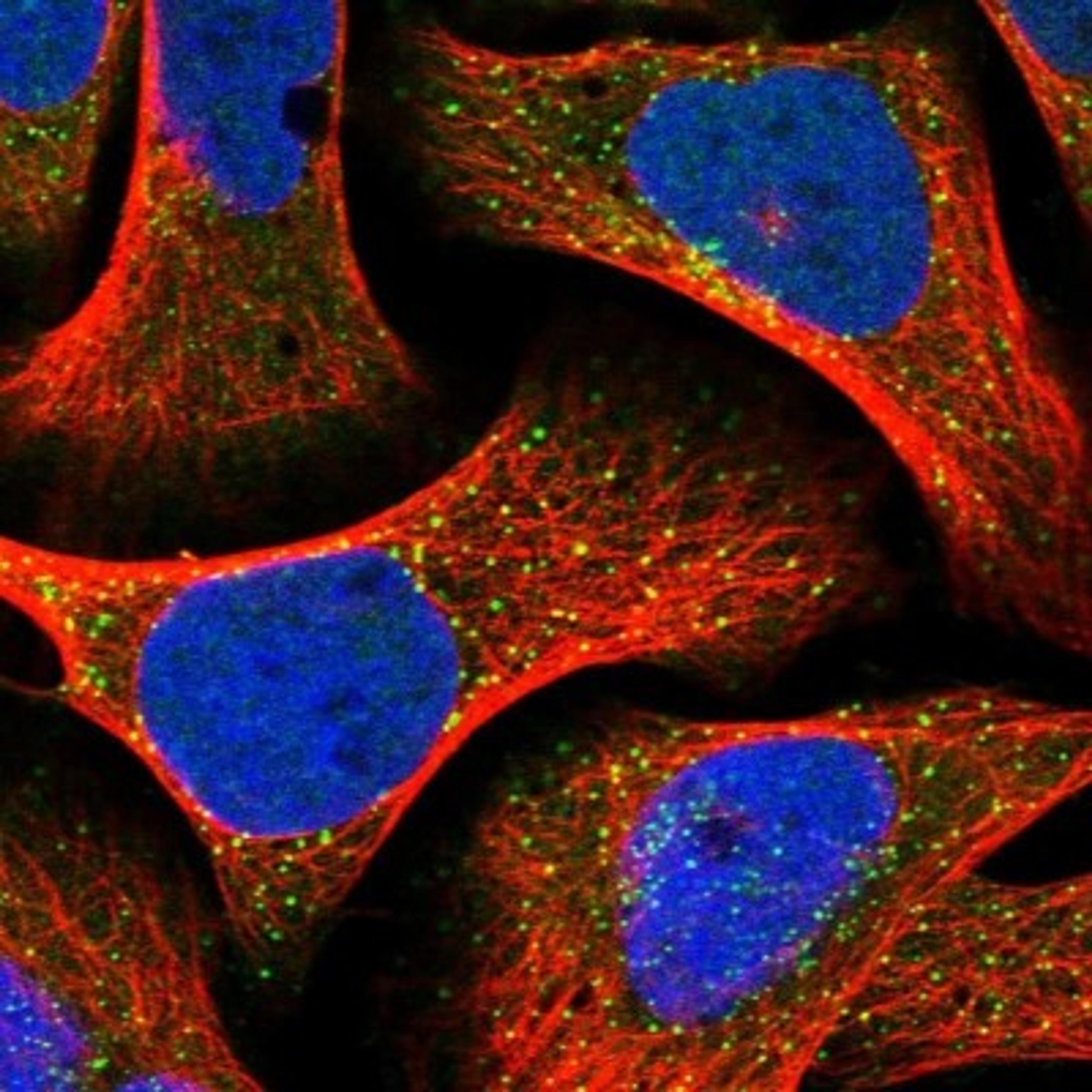 Immunocytochemistry/Immunofluorescence: HEY2 Antibody [NBP1-88629] - Staining of human cell line U-2 OS shows positivity in vesicles.