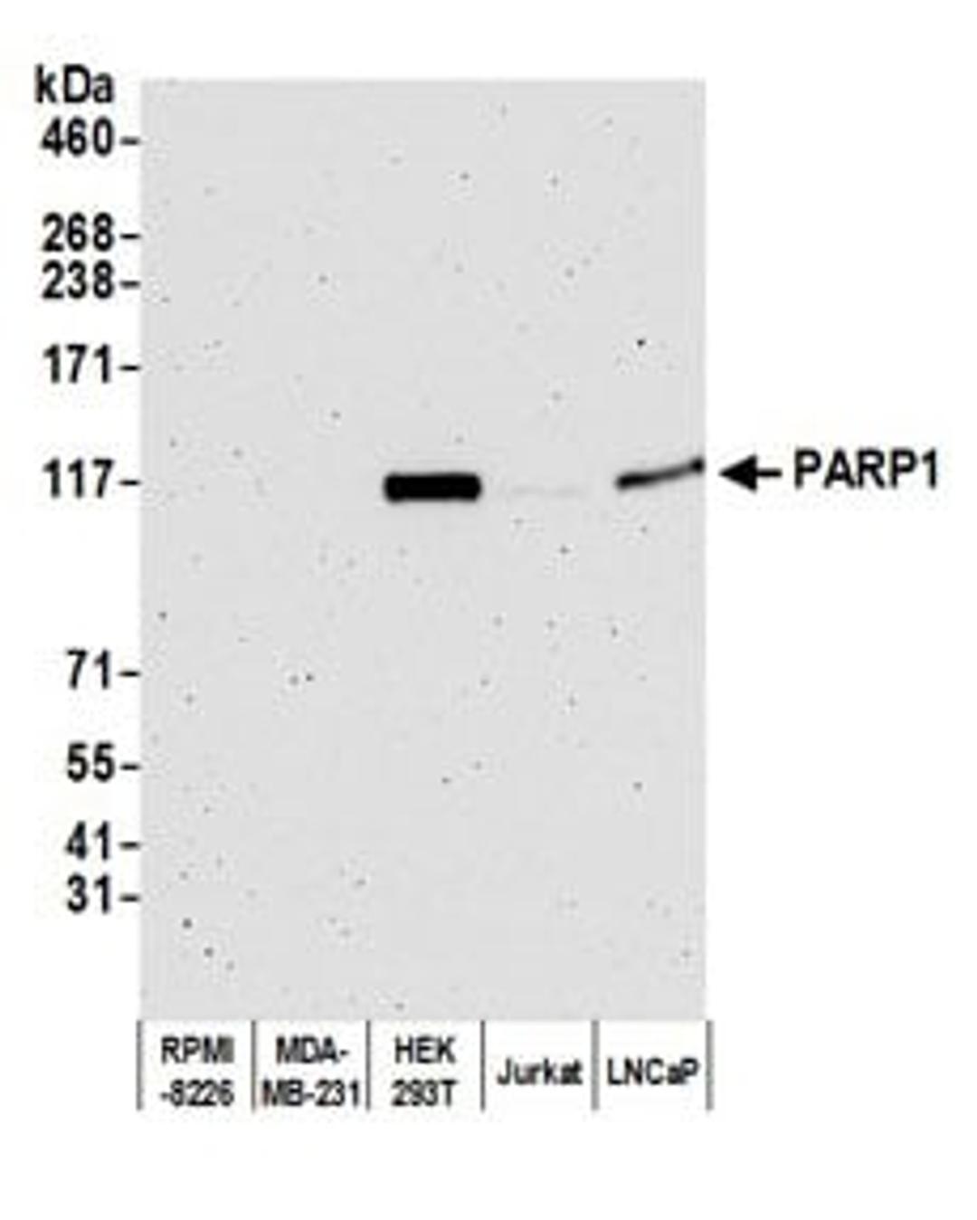 Detection of human PARP1 by western blot.