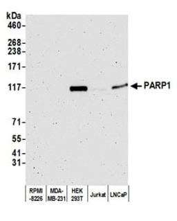 Detection of human PARP1 by western blot.