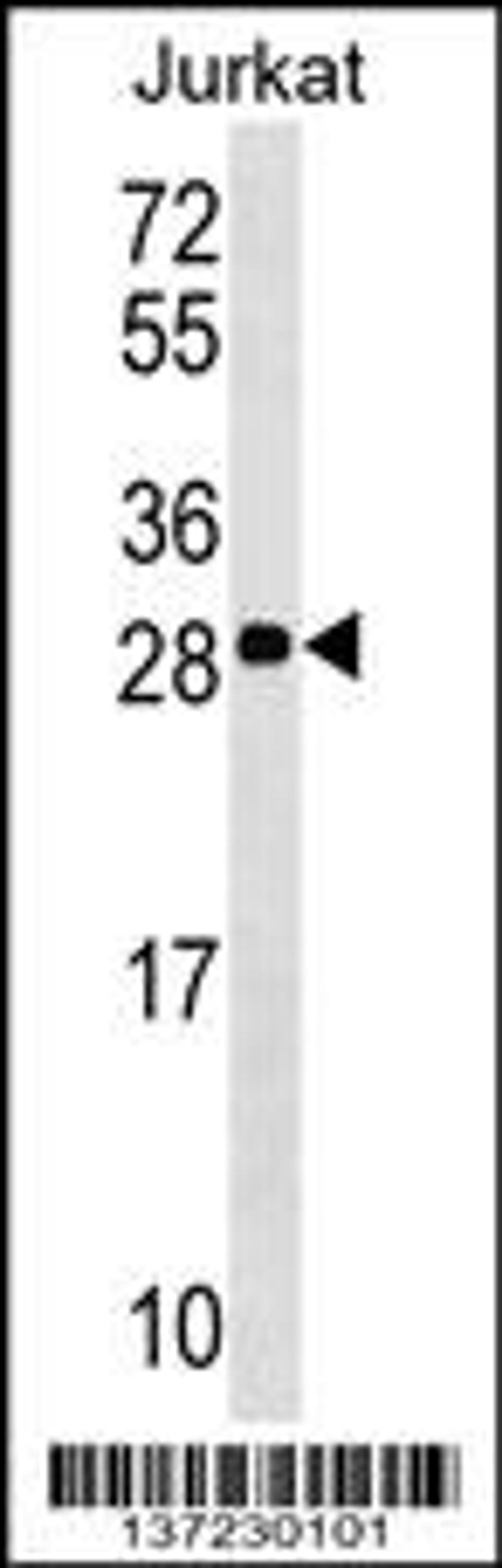 Western blot analysis in Jurkat cell line lysates (35ug/lane).