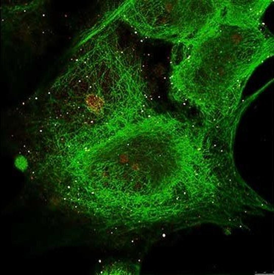 Immunofluorescence analysis of MCF-7 cell using Gli-3 antibody