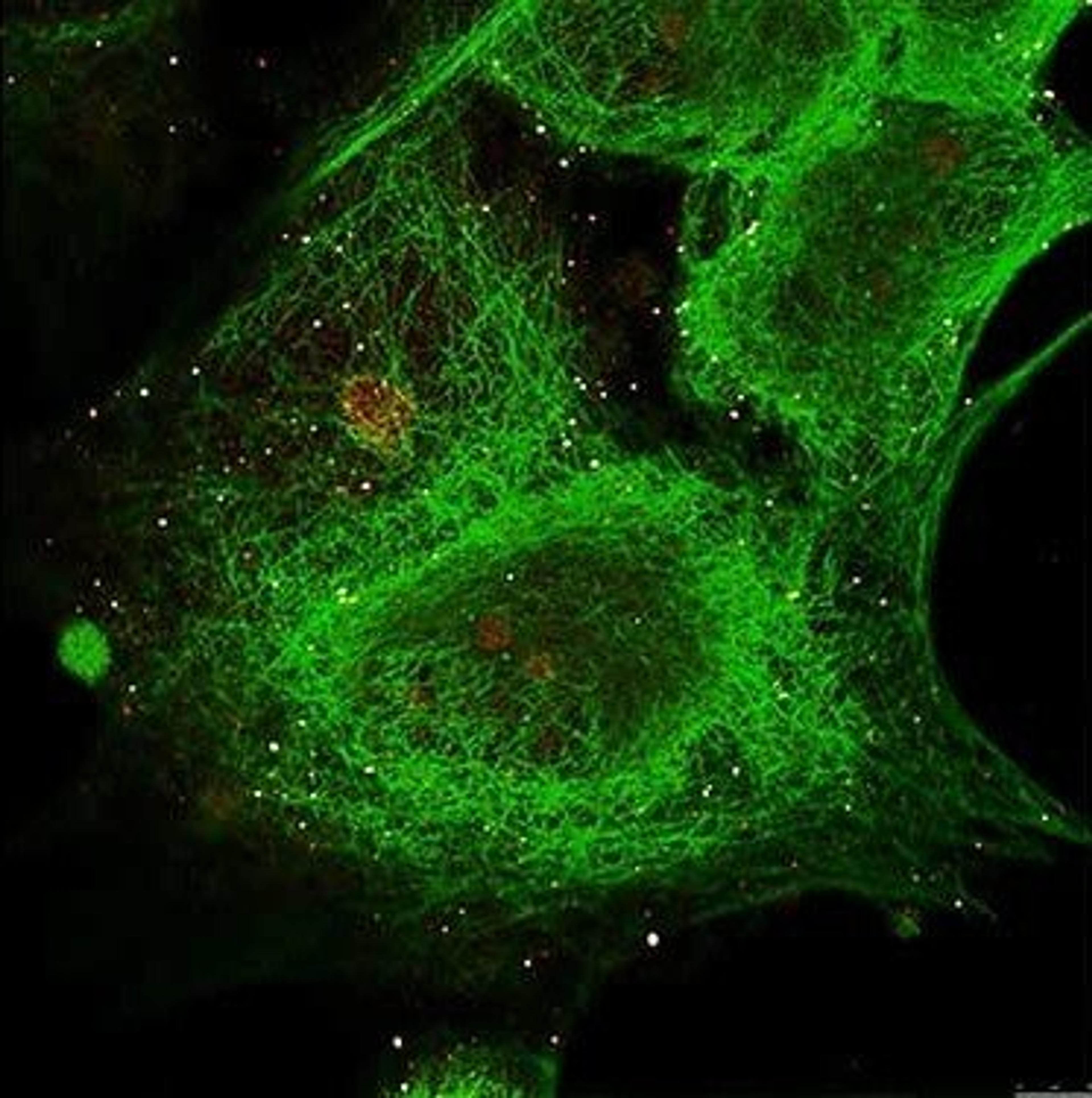 Immunofluorescence analysis of MCF-7 cell using Gli-3 antibody