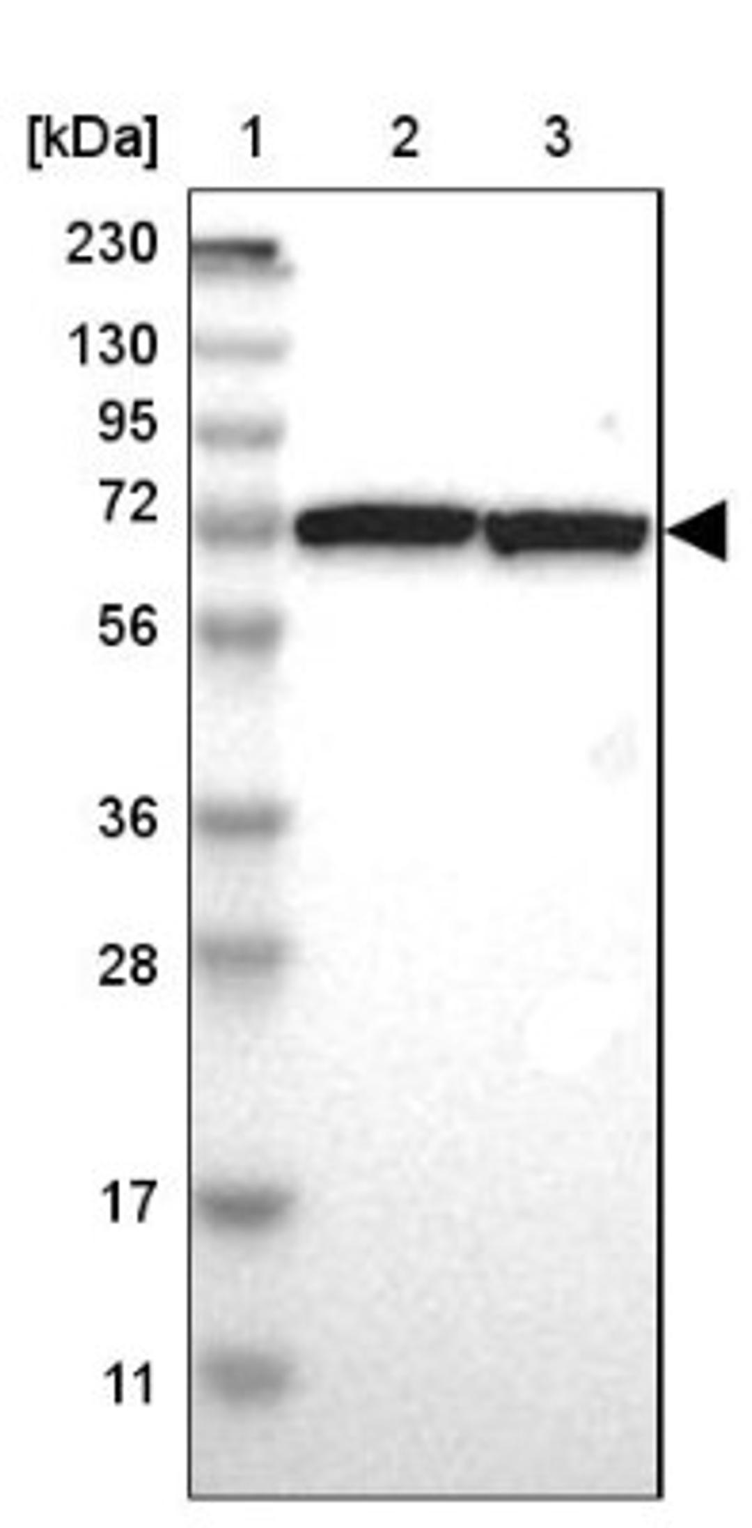 Western Blot: SWAP70 Antibody [NBP1-82979] - Lane 1: Marker [kDa] 230, 130, 95, 72, 56, 36, 28, 17, 11<br/>Lane 2: Human cell line RT-4<br/>Lane 3: Human cell line U-251MG sp