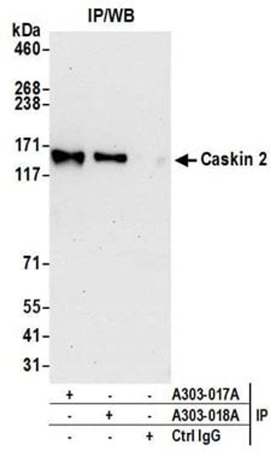 Detection of human Caskin 2 by western blot of immunoprecipitates.