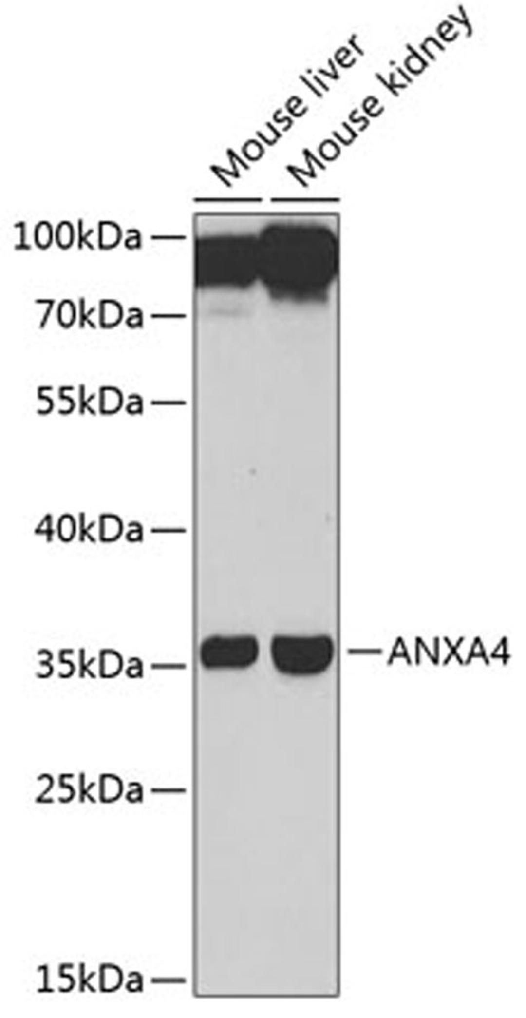 Western blot - ANXA4 antibody (A13466)