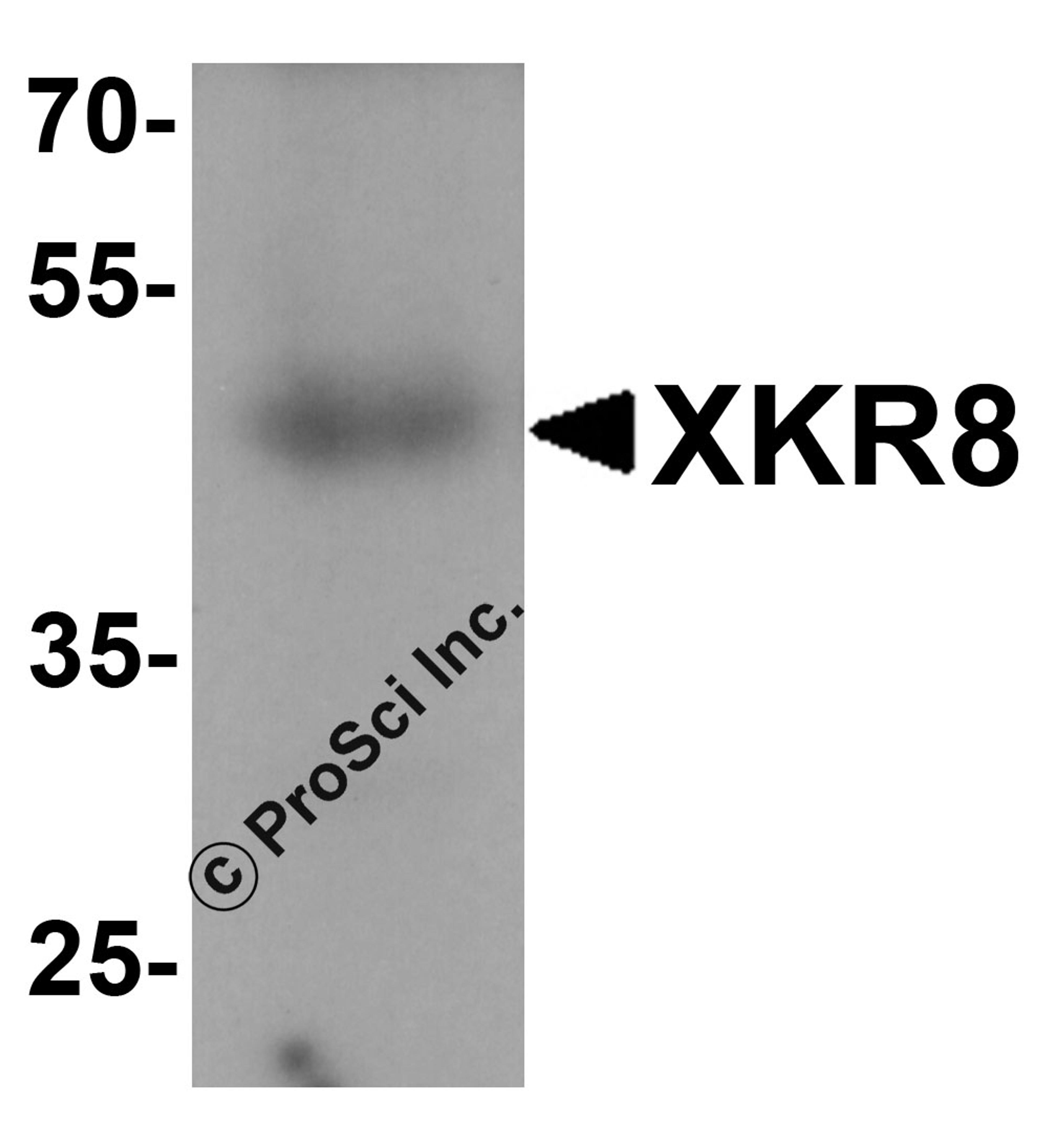 Western blot analysis of XKR8 in human stomach tissue lysate with XKR8 antibody at 1 &#956;g/ml.