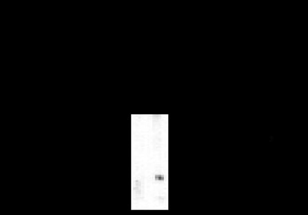 Western blot of rat caudate lysate showing phosphospecific immunolabeling of the ~32k DARPP-32 protein phosphorylated at Thr75.