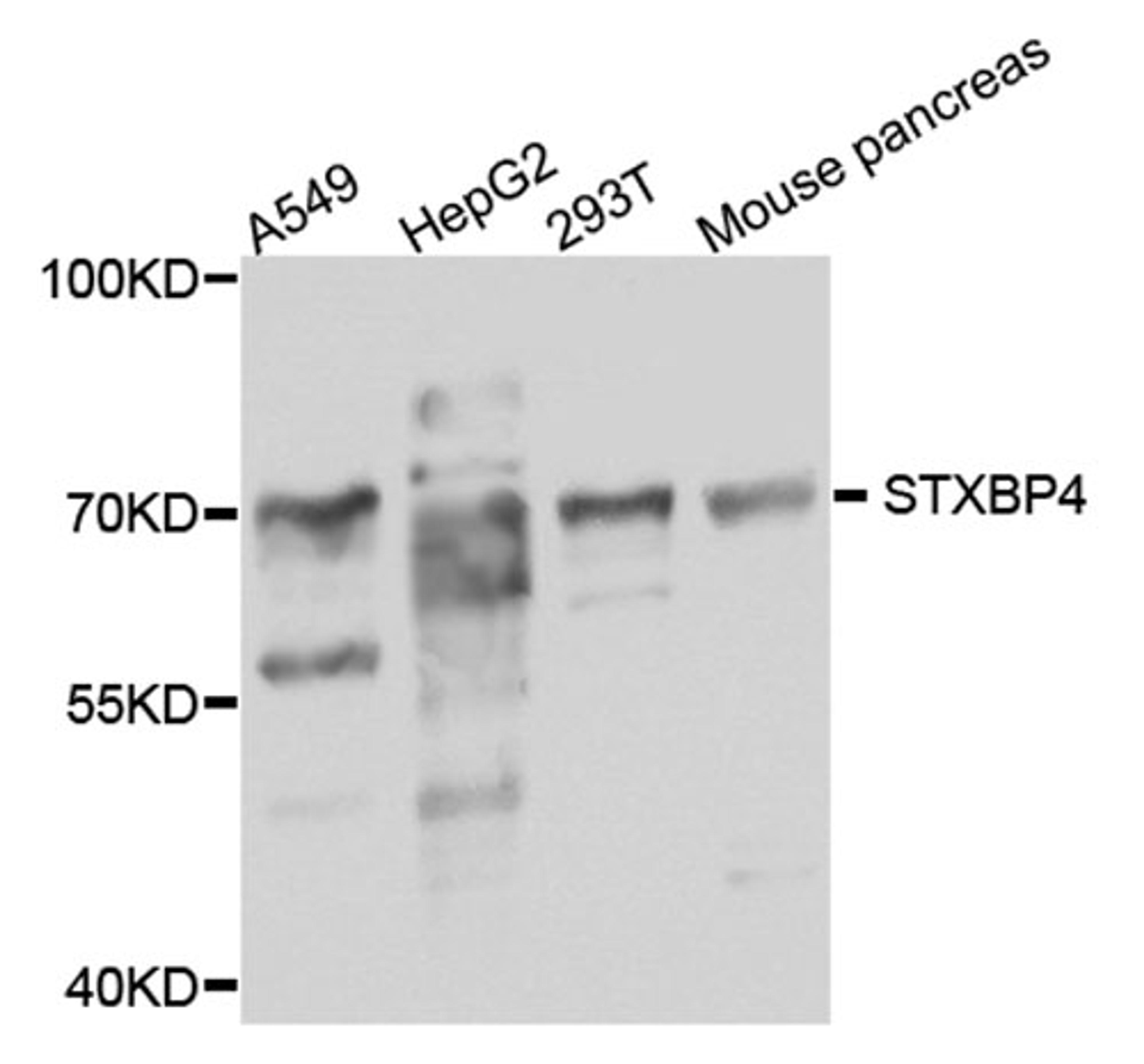 Western blot - STXBP4 antibody (A8287)