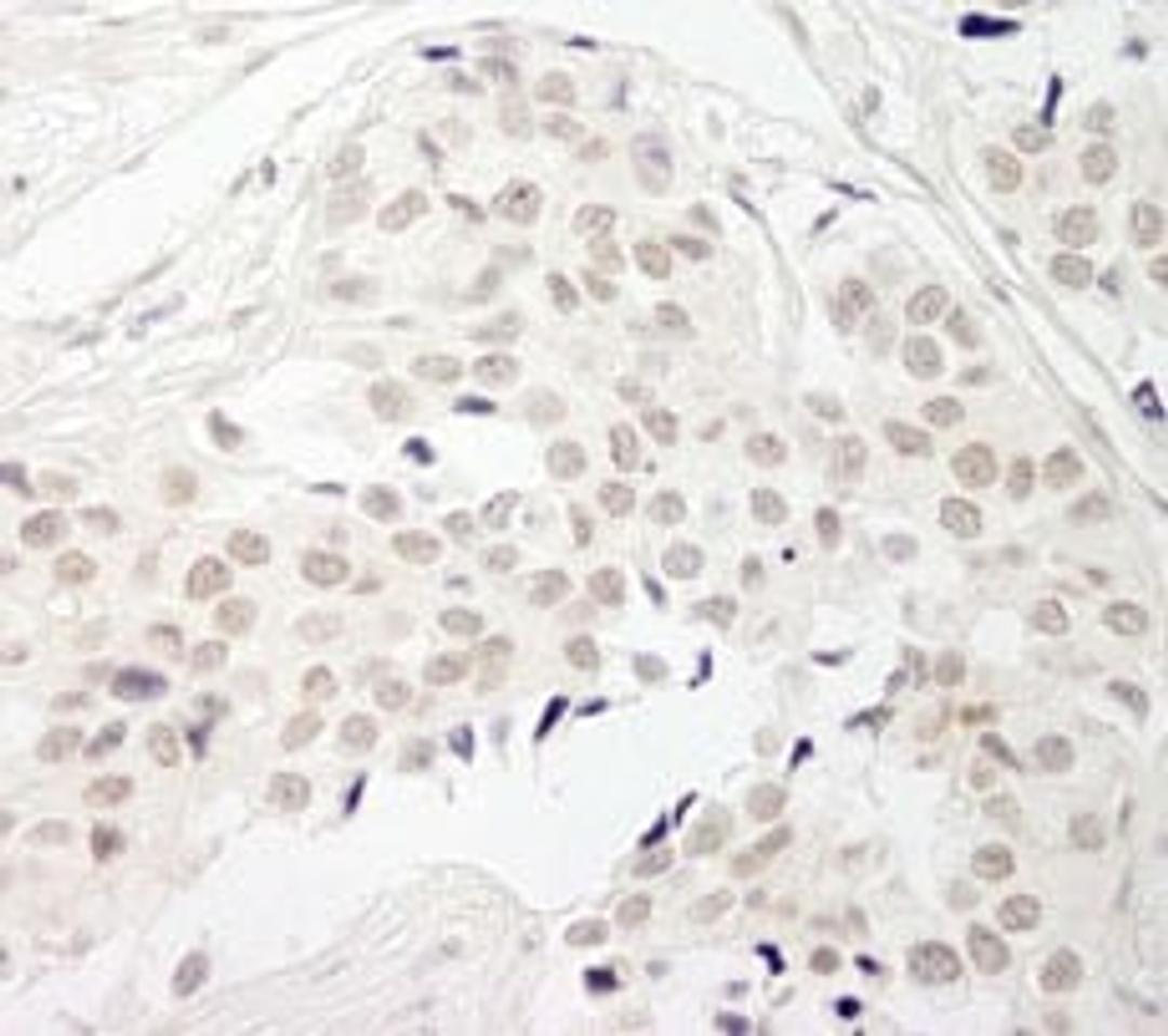 Detection of human PPP1CB by immunohistochemistry.