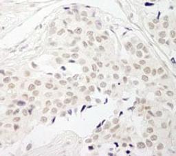 Detection of human PPP1CB by immunohistochemistry.