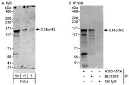 Detection of human C14orf43 by western blot and immunoprecipitation.