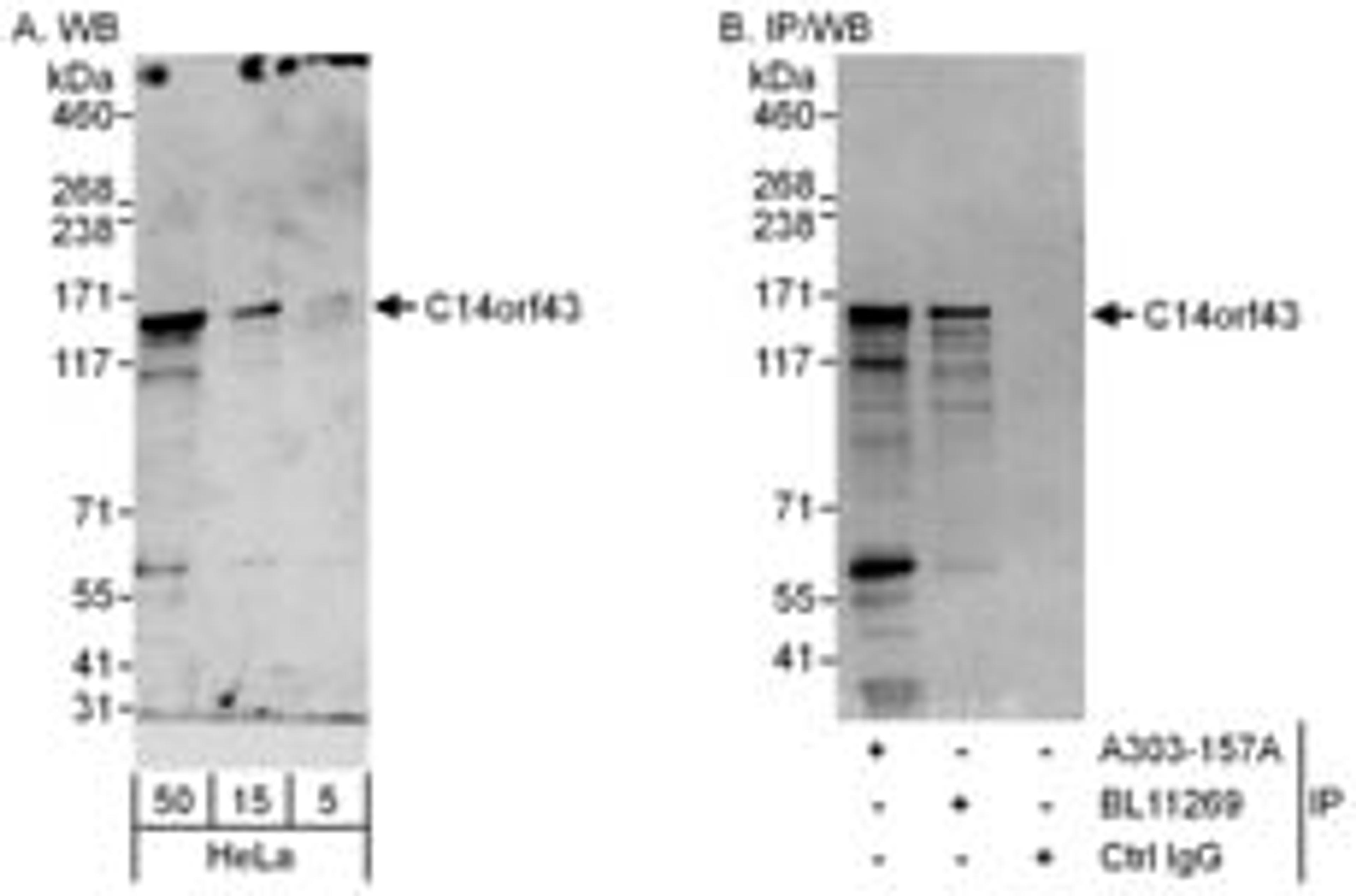 Detection of human C14orf43 by western blot and immunoprecipitation.