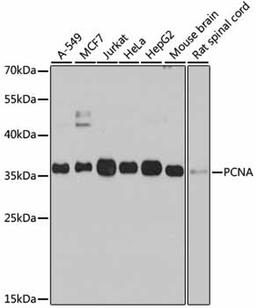 Western blot - PCNA antibody (A0264)