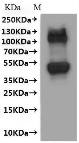 CSB-MP021717HU(A4) is detected by Mouse anti-6*His monoclonal antibody.