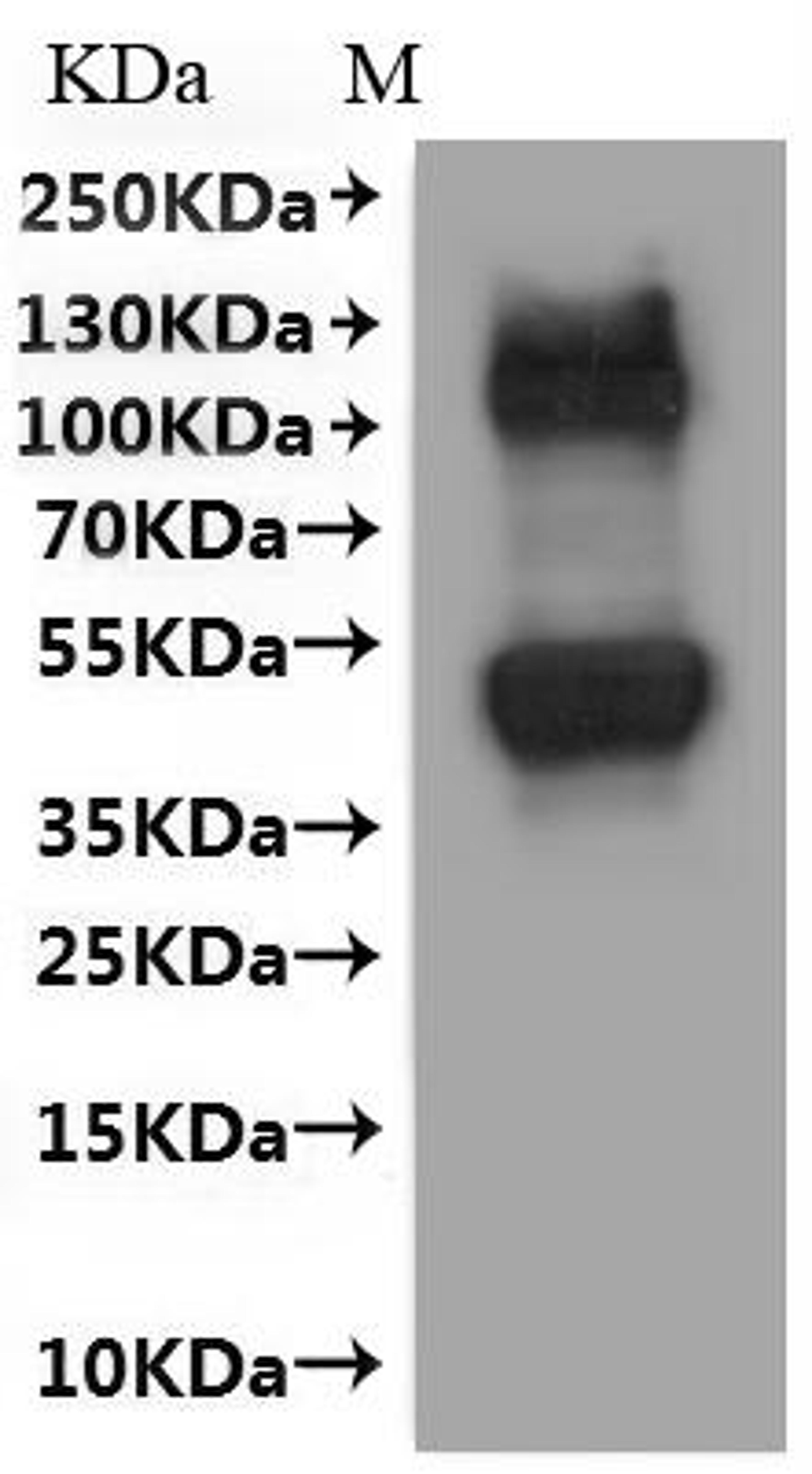 CSB-MP021717HU(A4) is detected by Mouse anti-6*His monoclonal antibody.
