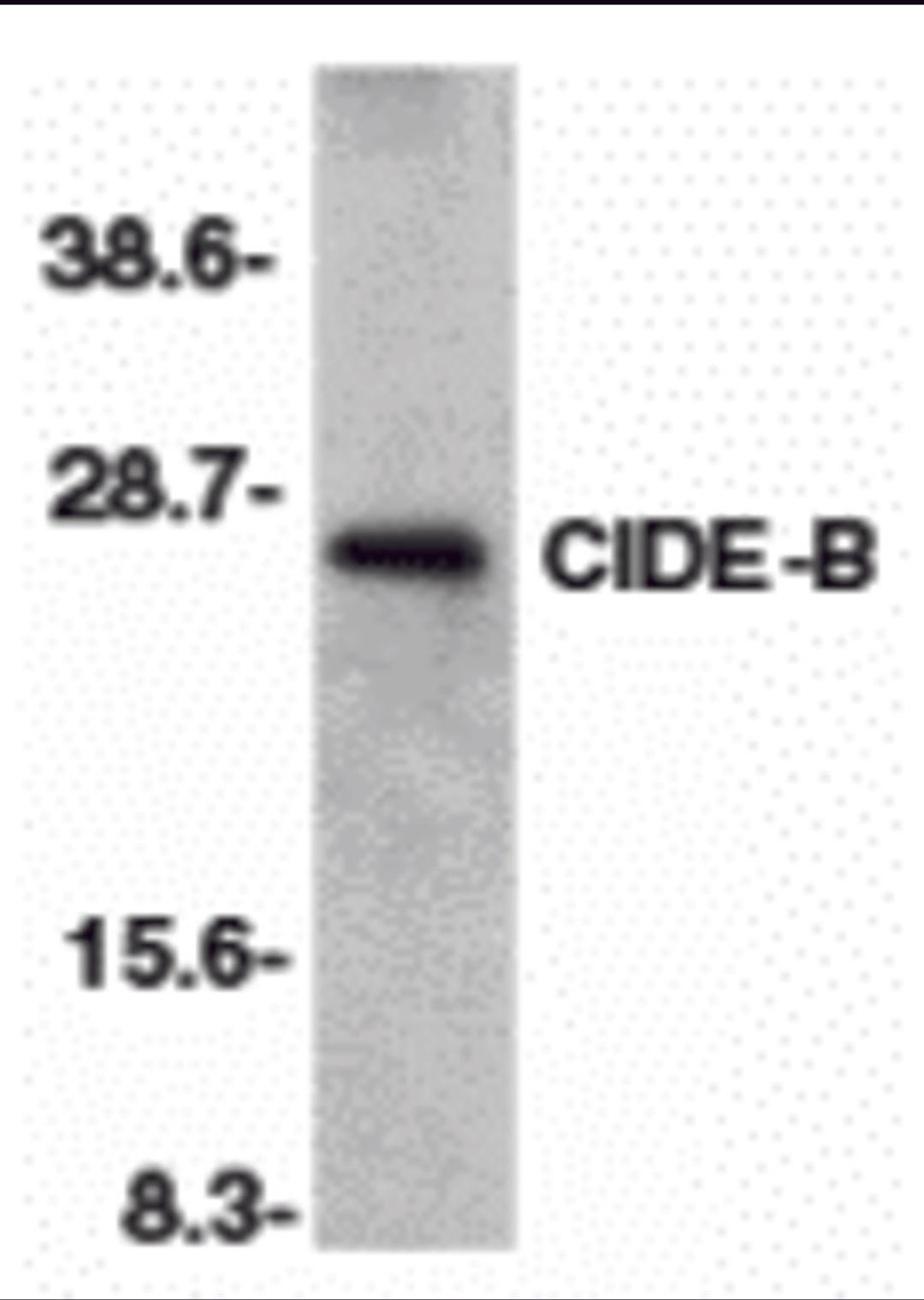 Western blot analysis of CIDE-B in mouse liver tissue lysate with CIDE-B antibody at 1:500 dilution.