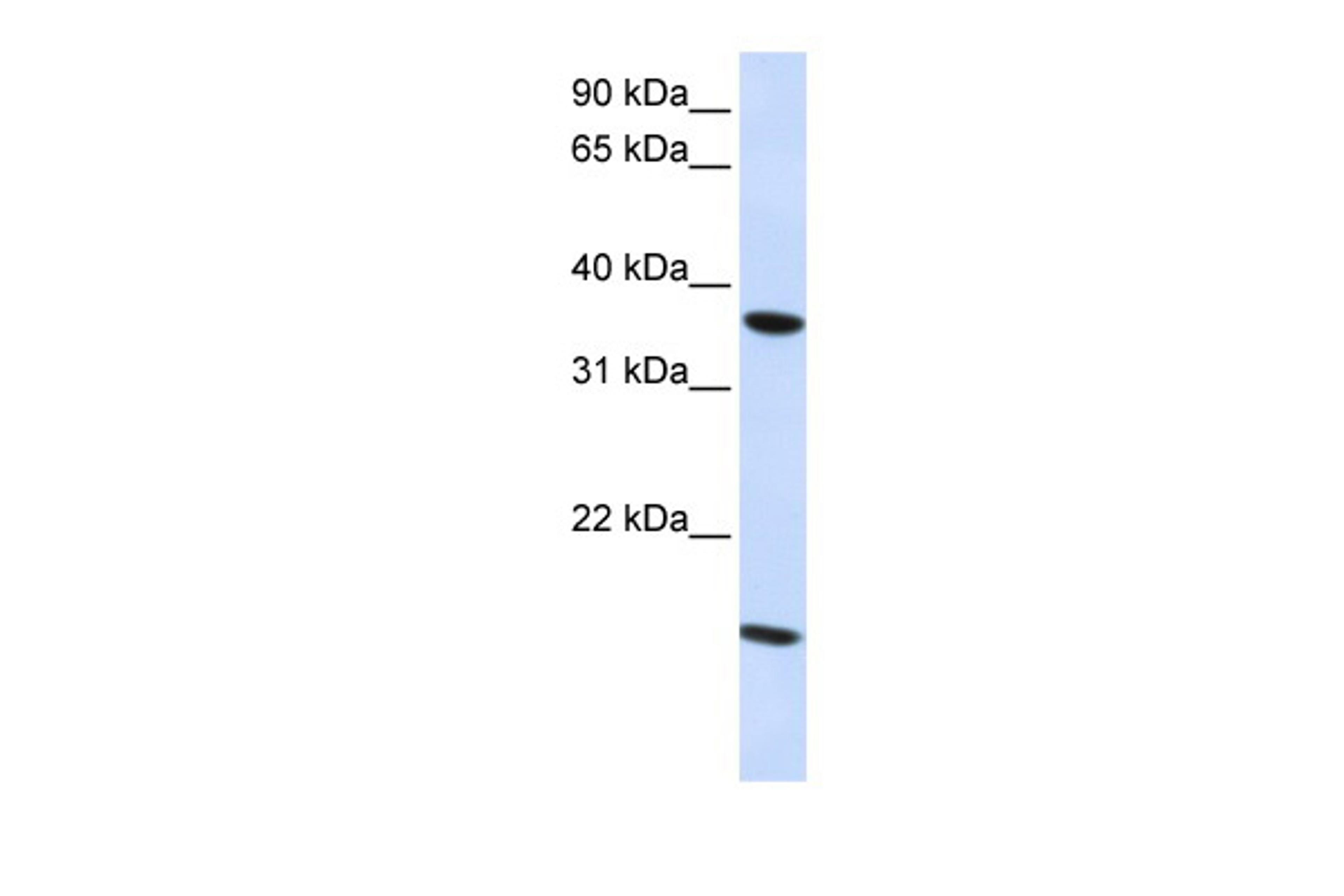 Antibody used in WB on Human Fetal Kidney at 1.25 ug/ml.