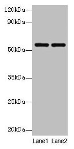 Western blot. All lanes: PHGDH antibody at 2µg/ml. Lane 1: EC109 whole cell lysate. Lane 2: 293T whole cell lysate. Secondary. Goat polyclonal to rabbit IgG at 1/10000 dilution. Predicted band size: 57 kDa. Observed band size: 57 kDa