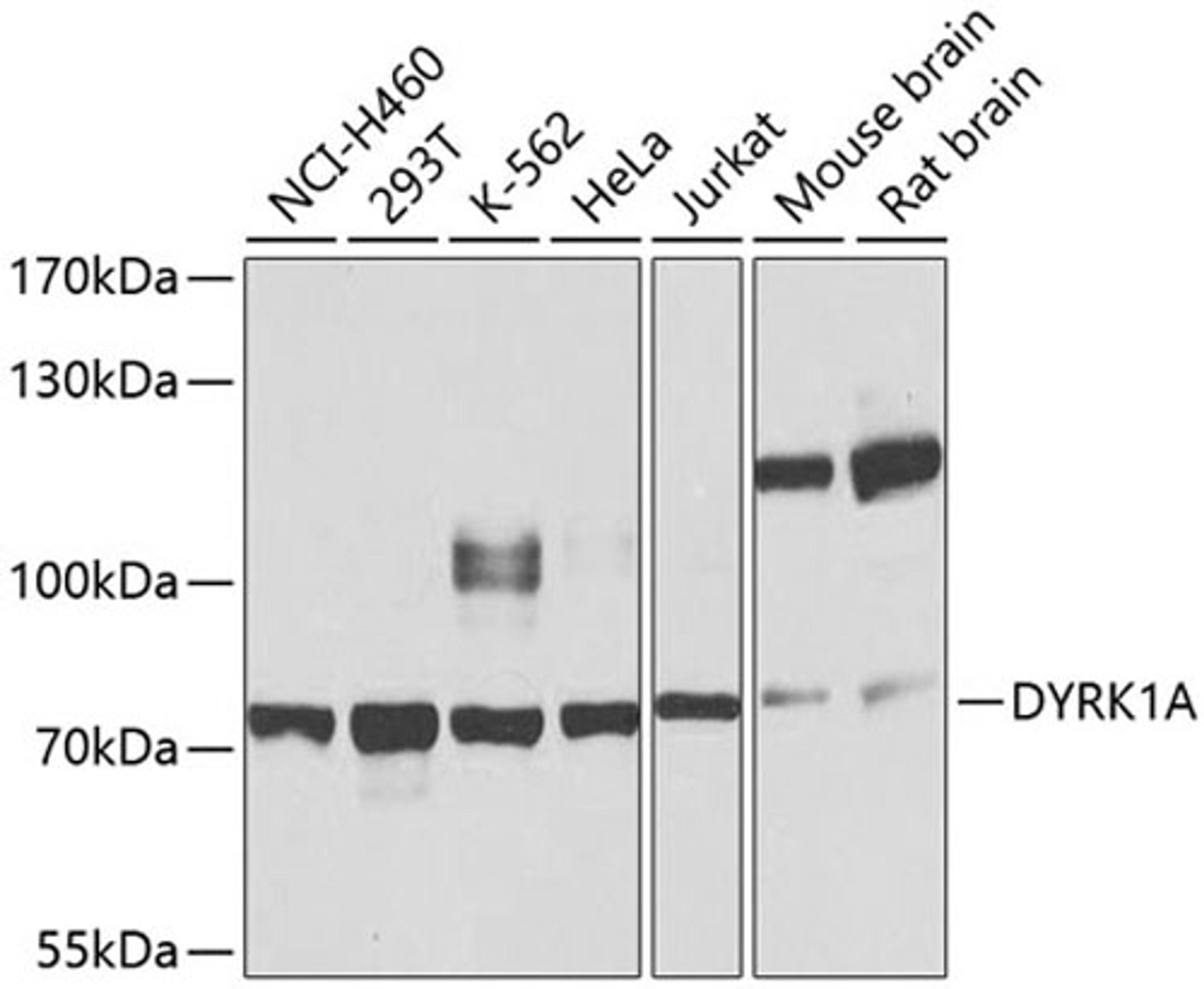 Western blot - DYRK1A antibody (A0595)