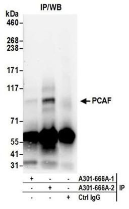 Detection of human PCAF by western blot of immunoprecipitates.