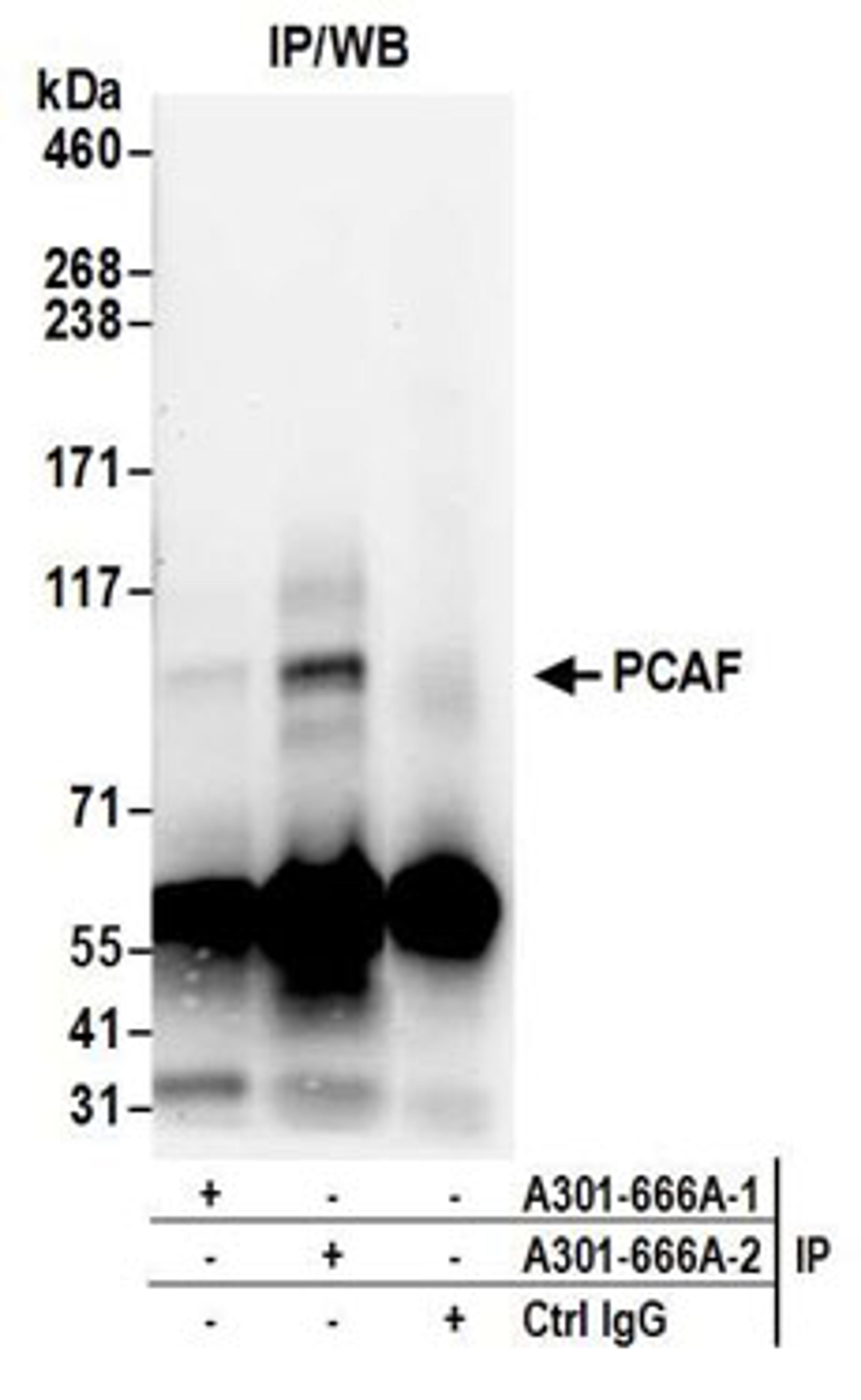 Detection of human PCAF by western blot of immunoprecipitates.