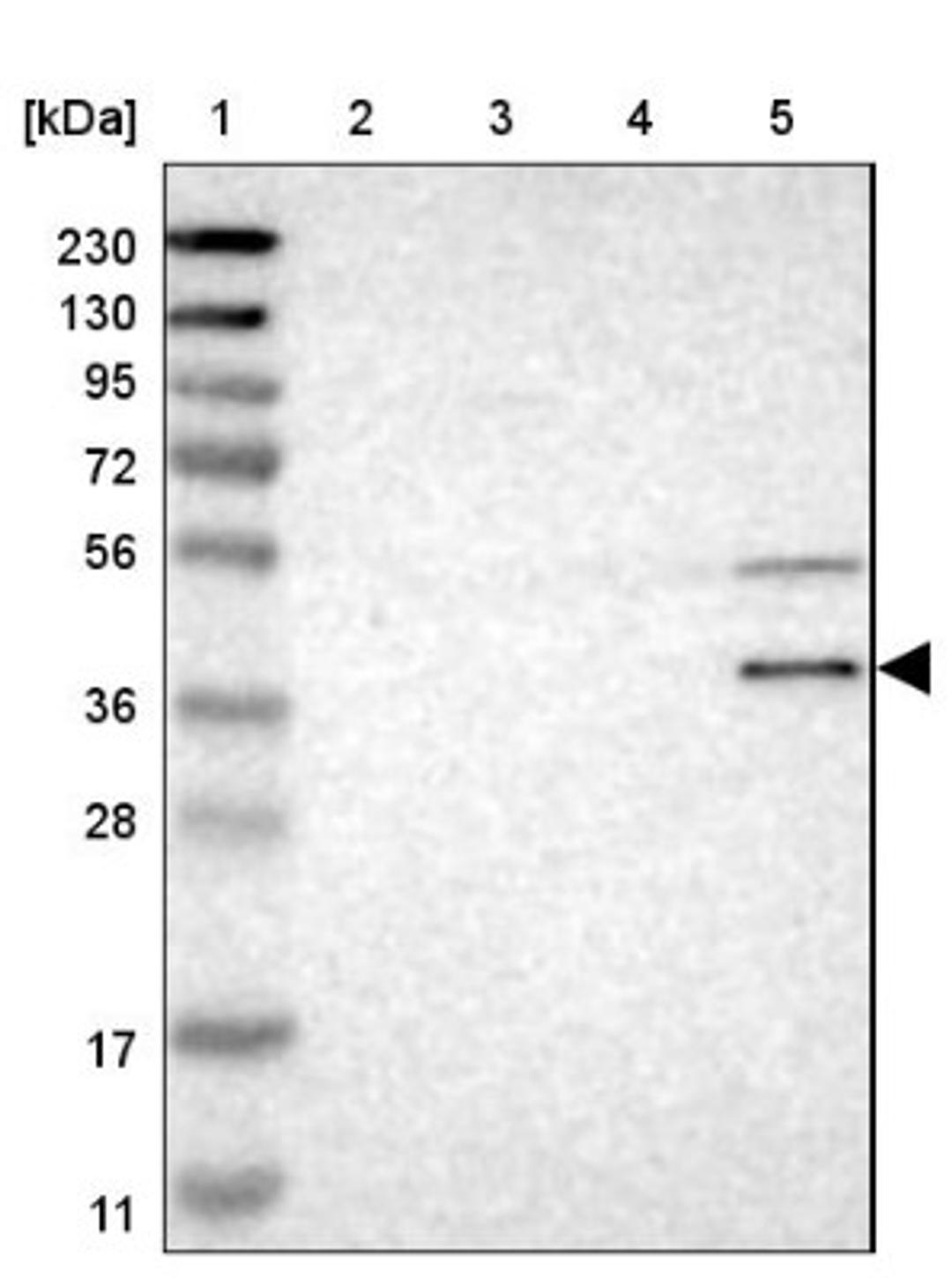 Western Blot: WNT7A Antibody [NBP1-86071] - Lane 1: Marker [kDa] 230, 130, 95, 72, 56, 36, 28, 17, 11<br/>Lane 2: Human cell line RT-4<br/>Lane 3: Human cell line U-251MG sp<br/>Lane 4: Human plasma (IgG/HSA depleted)<br/>Lane 5: Human liver tissue