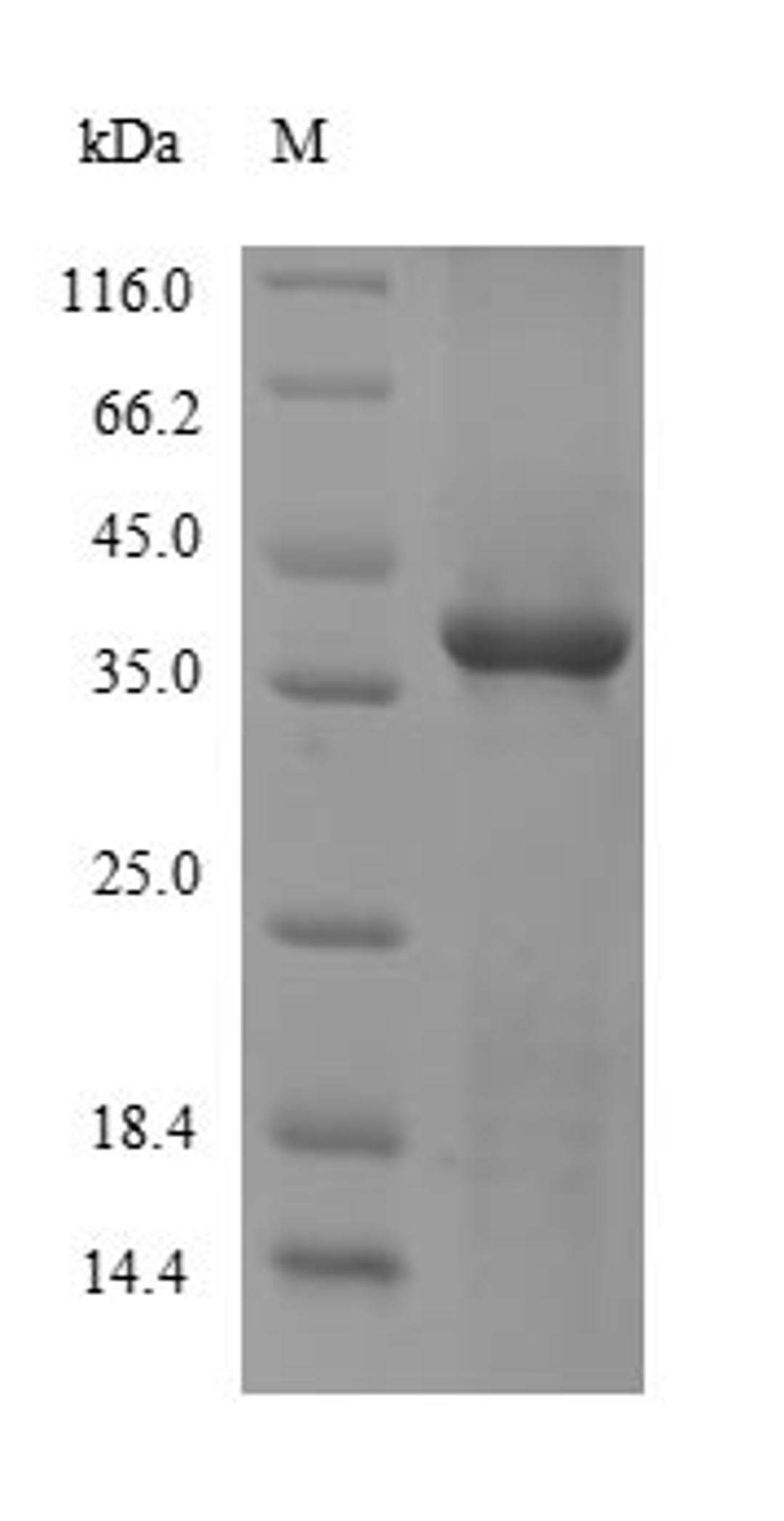 (Tris-Glycine gel) Discontinuous SDS-PAGE (reduced) with 5% enrichment gel and 15% separation gel.