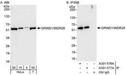 Detection of human GRWD1/WDR28 by western blot and immunoprecipitation.