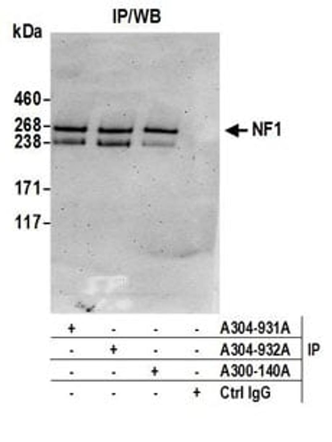 Detection of human NF1 by western blot of immunoprecipitates.