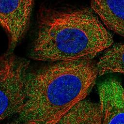 Immunocytochemistry/Immunofluorescence: FHOD1 Antibody [NBP1-83900] Staining of human cell line A-431 shows positivity in cytoplasm.