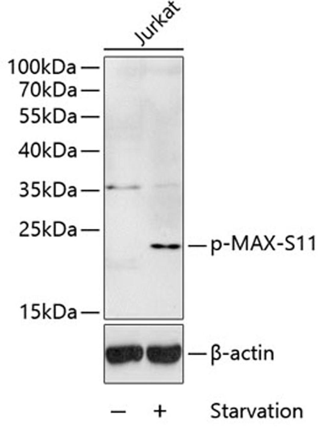 Western blot - Phospho-MAX-S11 antibody (AP0072)