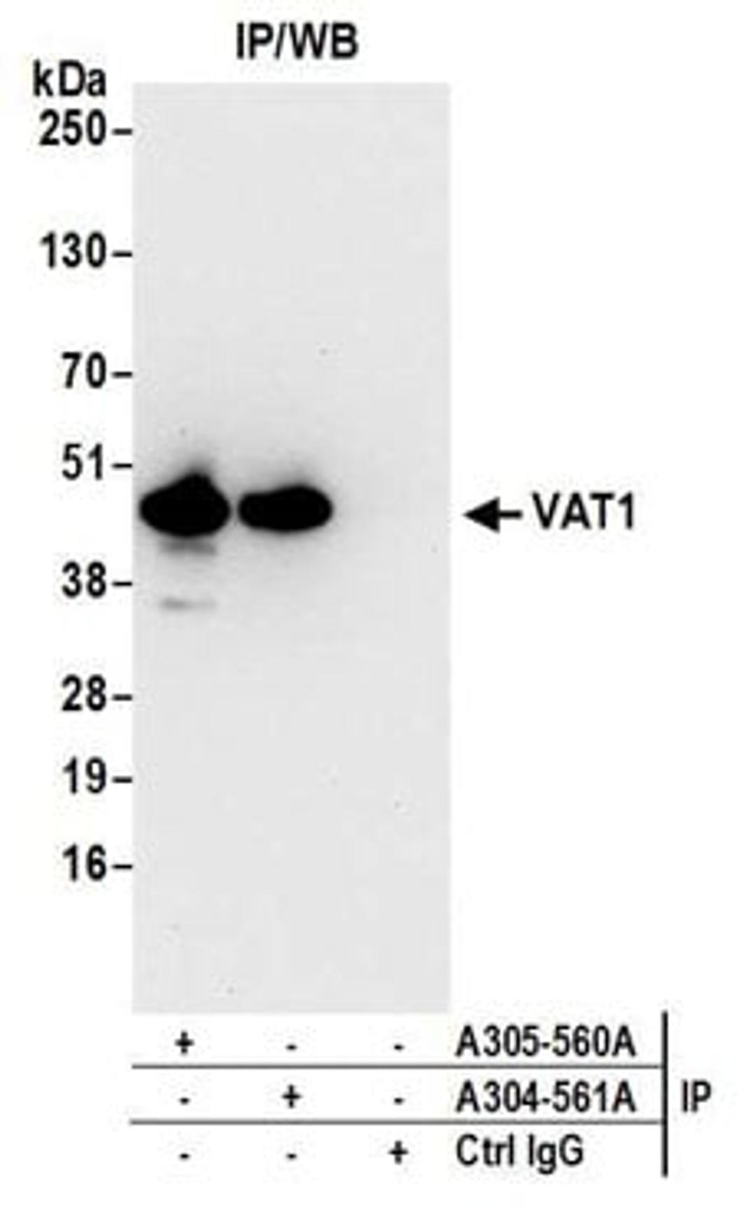 Detection of human VAT1 by western blot of immunoprecipitates.