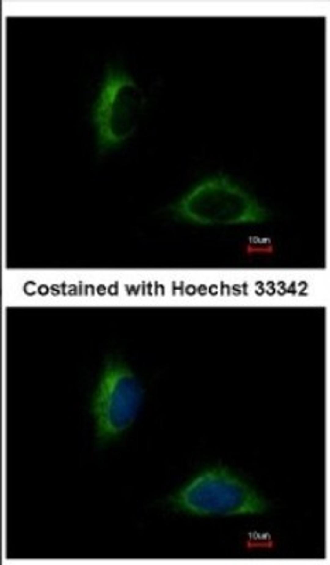 Immunocytochemistry/Immunofluorescence: FAM171A1 Antibody [NBP2-16414] - Immunofluorescence analysis of methanol-fixed HeLa, using antibody at 1:500 dilution.