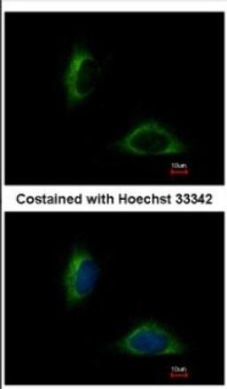 Immunocytochemistry/Immunofluorescence: FAM171A1 Antibody [NBP2-16414] - Immunofluorescence analysis of methanol-fixed HeLa, using antibody at 1:500 dilution.