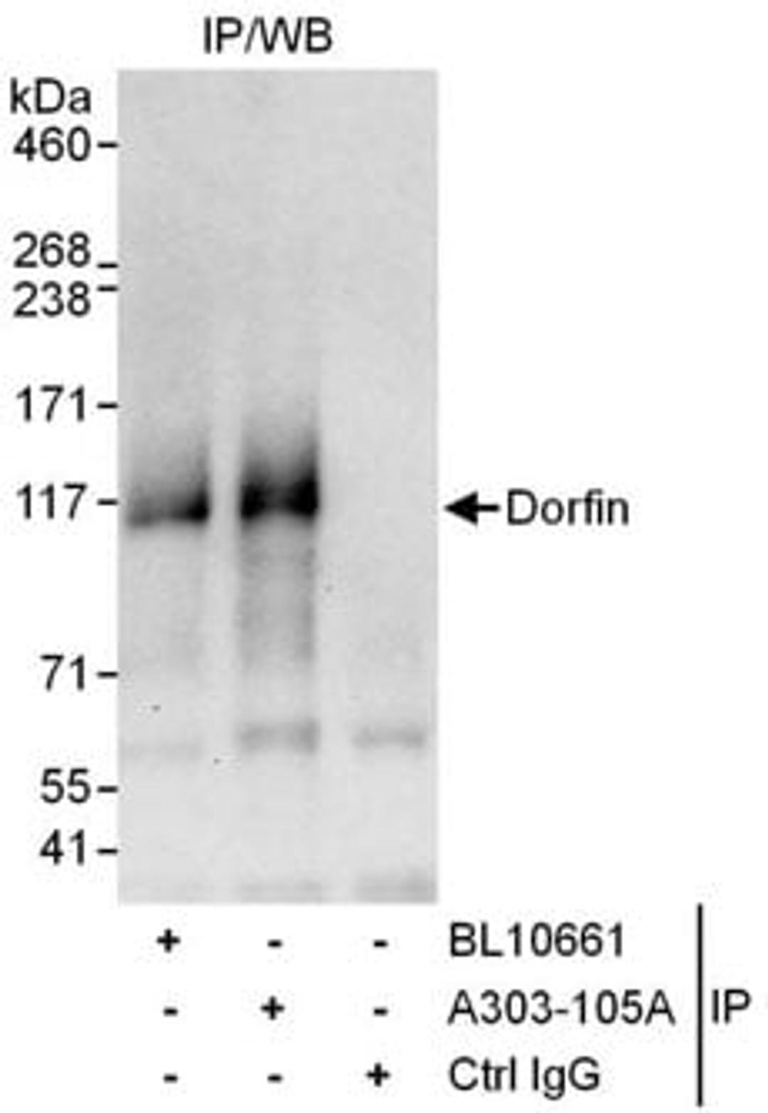 Detection of human Dorfin by western blot of immunoprecipitates.